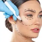 Pourquoi avoir recours à la chirurgie esthétique