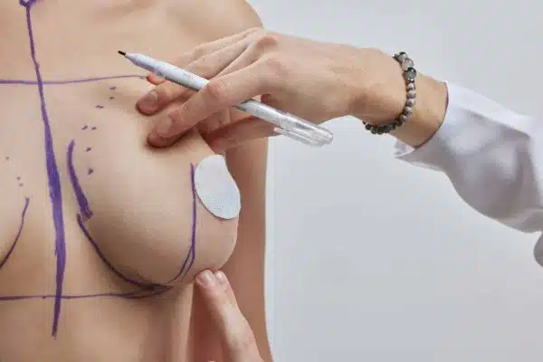 5 raisons qui poussent les femmes à passer par une réduction mammaire