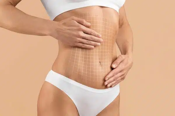 Abdominoplastie : Les coûts et les assurances